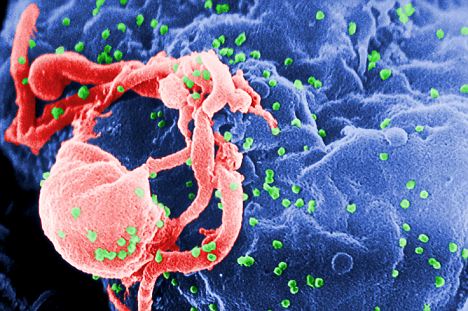 hiv hiv