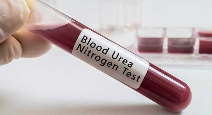 que significa nitrogeno de urea en sangre