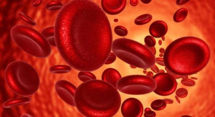 anemia-por-deficiencia-de-hierro