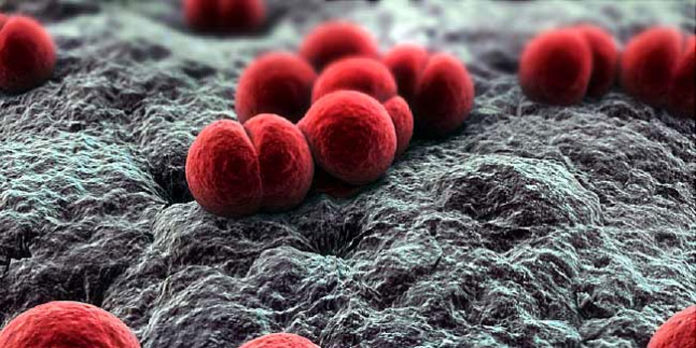 meningitis